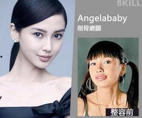 西安整容爆料案件最新,揭开医美行业潜规则与患者权益受损之谜